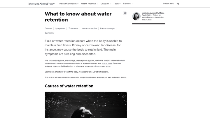 Screenshot: MedicalNewsToday article page highlighting edema (water retention) causes and symptoms.